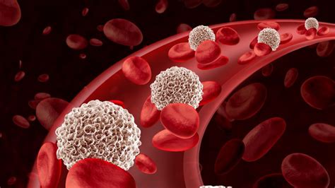 остеохондроза бели кръвни клетки